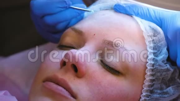 美容师的面部机械清洁美容师用挤压法挤压病人前额上的痤疮视频的预览图