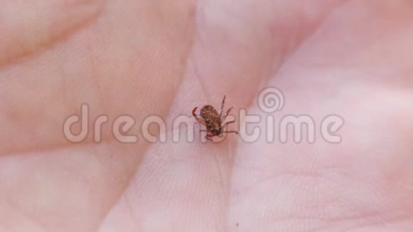 吸血昆虫米特人类手掌上的昆虫躺在它的背上勾住镊子视频的预览图