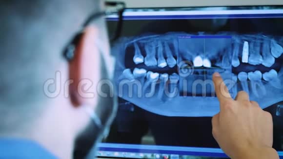 牙医正在研究颌骨的x射线三维图像视频的预览图