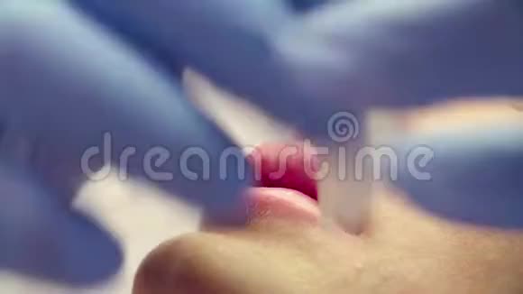 医生擦拭病人嘴唇视频的预览图