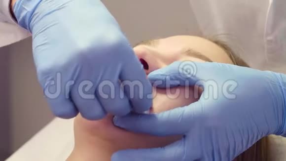 医生用手按摩病人嘴唇视频的预览图