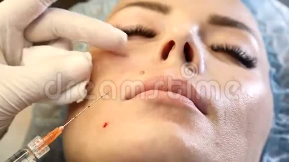 医务室的女人美容注射程序美容师拿着针管注射器的特写镜头视频的预览图