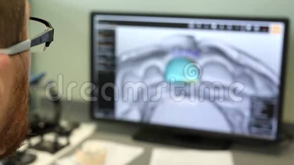 做牙冠戴眼镜的人在电脑里工作在没有重点的室内特写视频的预览图
