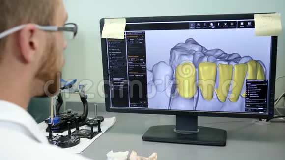 牙科的现代技术戴眼镜的年轻工程师在实验室电脑上看人牙模型视频的预览图