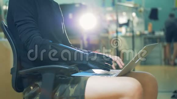 残疾人使用笔记本电脑工作在键盘上打字戴着假肢4K视频的预览图