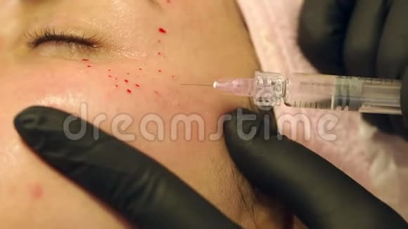 美容师让这个过程生物化是一个年轻的女孩视频的预览图