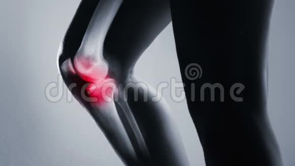 人膝关节和腿部x光灰色背景视频的预览图