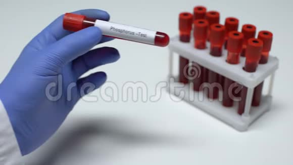 磷医生在试管中显示血样实验室研究健康检查视频的预览图