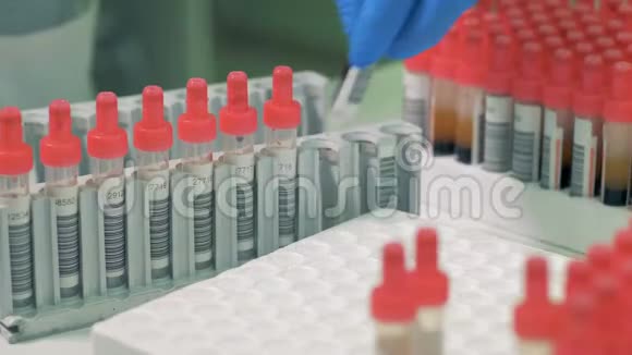 试管中的血液样本被检查并插入调色板视频的预览图