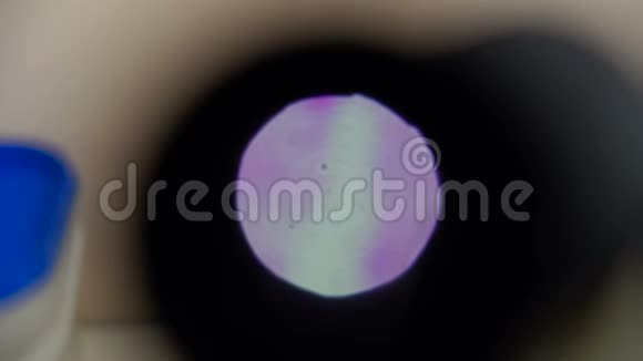 显微镜下的淋病分子视频的预览图