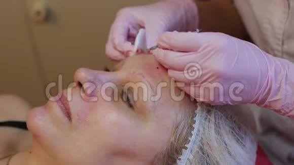 美容师在水疗美容店做痤疮治疗使用机械仪器医疗概念视频的预览图