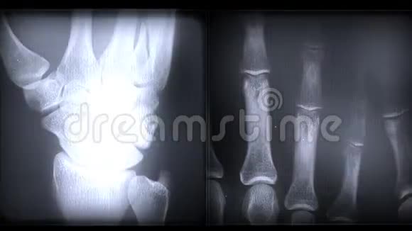 X光人体骨骼视频的预览图
