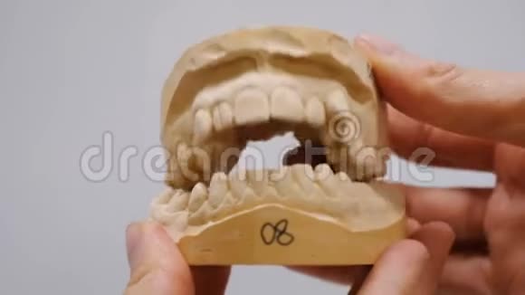 安装支架系统前牙齿的石膏模型医生关闭并打开下巴的石膏模型视频的预览图