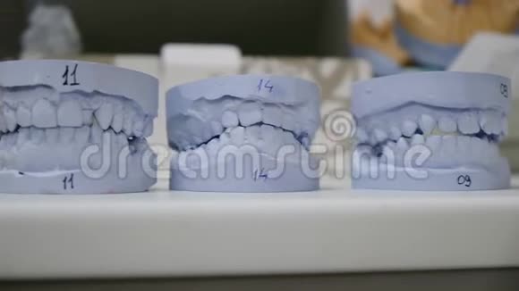 石膏模型的牙齿排成一排站在桌子上相机移动牙医办公室里的霉菌石膏下巴视频的预览图