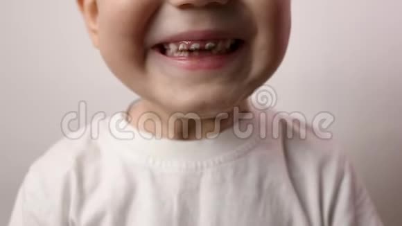 把男孩的牙齿贴紧保健牙齿卫生牙齿问题龋齿视频的预览图