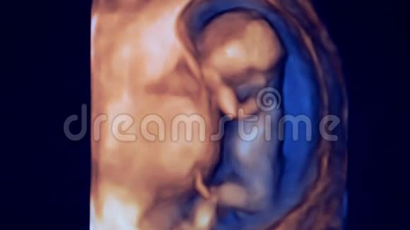 母亲子宫中一个微小胎儿形象视频的预览图