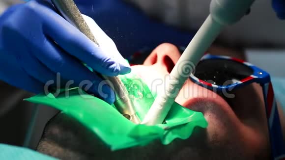 一个女人拿着一个牙医在牙医办公室里钻孔病人的牙齿并用栅栏把牙齿的残余物围起来视频的预览图