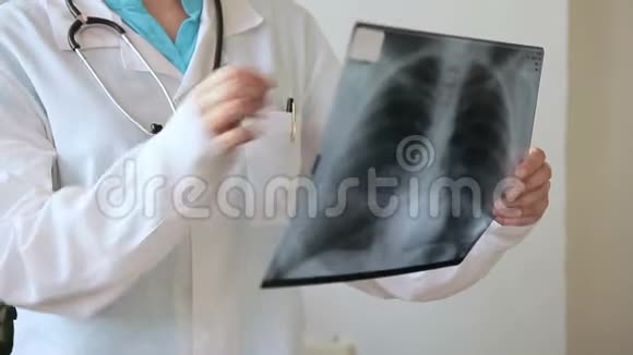 医生用钢笔用x线显示病人胸部疼痛来源视频的预览图
