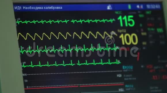带有数据的心电监护仪视频的预览图