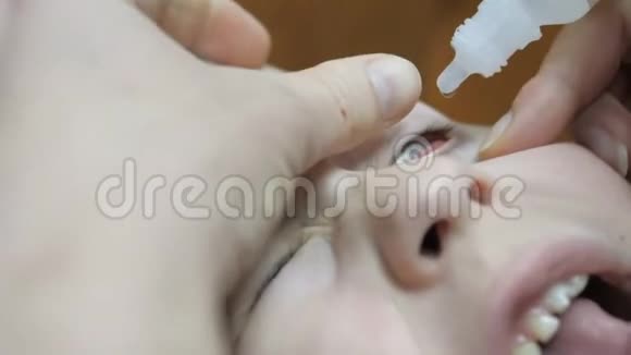 在眼科诊所的孩子给一个小男孩滴眼液视频的预览图