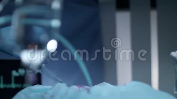 外科医生握手外科团队祝贺手术成功视频的预览图