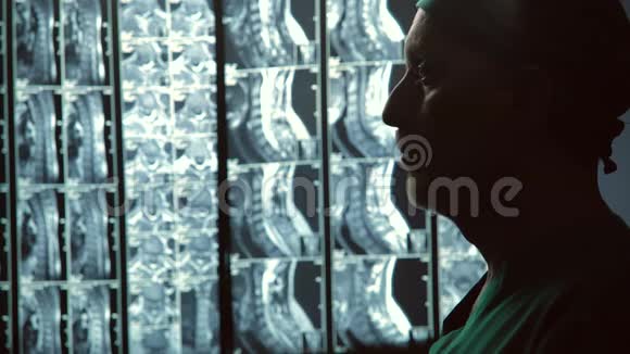 严重的男性治疗师看核磁共振扫描摩擦下巴不治之症视频的预览图