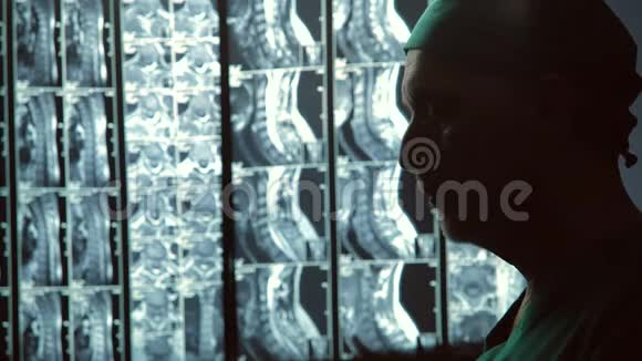 专注于脊柱核磁共振扫描的医生工作诊断专家视频的预览图