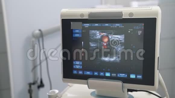 超声检查装置监测特写彩色人体器官医院或诊所的医疗工具视频的预览图