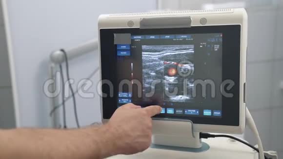超声检查装置监测特写彩色人体器官医院或诊所的医疗工具视频的预览图
