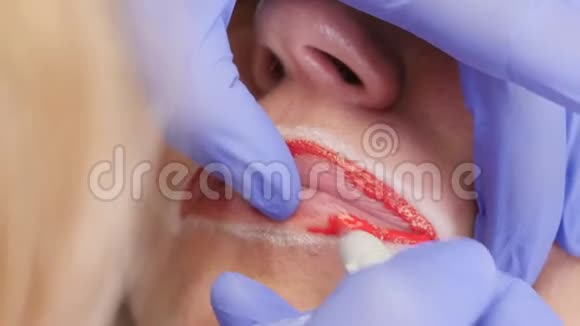 闭唇治疗女性客户嘴唇永久性化妆程序视频的预览图