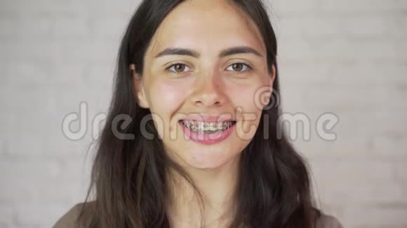 人表情和情感的概念带着牙套的快乐微笑的年轻女人视频的预览图