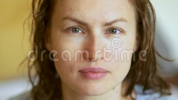 年轻漂亮的女人有斜视的迹象眼科症状人脸视频的预览图