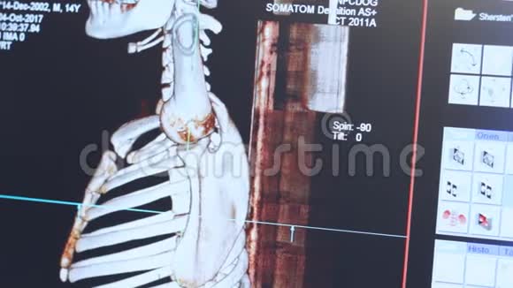 病人骨骼磁共振成像医生视频的预览图