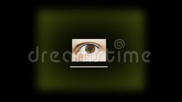 眼科扫描仪视频的预览图