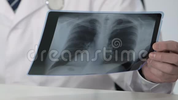 肿瘤学专家支持健康患者的肺部扫描为诊断提供了依据视频的预览图