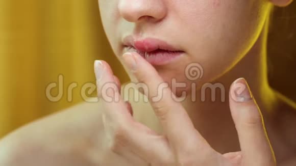 美丽的女人在她的上唇与疱疹上与疱疹视频的预览图