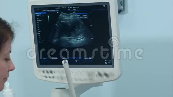 女性妇科医生用超声波扫描仪检查胎儿生命视频的预览图