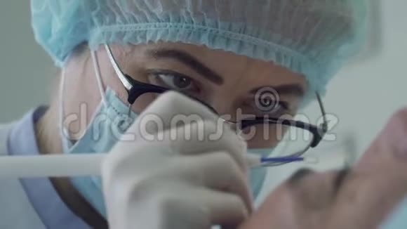 皮肤科医生用激光清除人体表面的痣视频的预览图