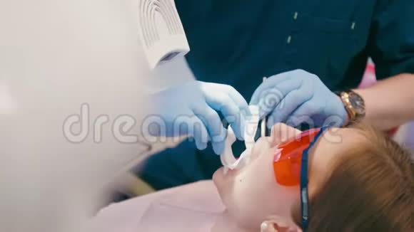 牙医正在牙科诊所为病人准备牙齿美白手术视频的预览图