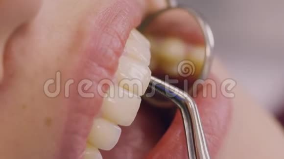牙医清洁持牙工具检查镜面牙科中心视频的预览图