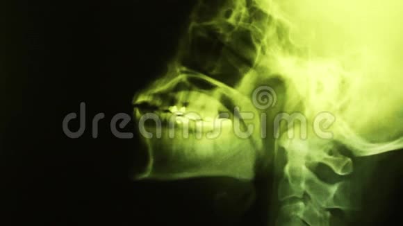 X射线骨架解剖观视频的预览图