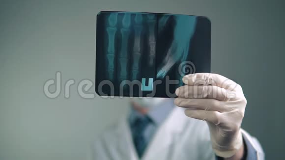 医院的一位医生考虑用X光检查手部视频的预览图