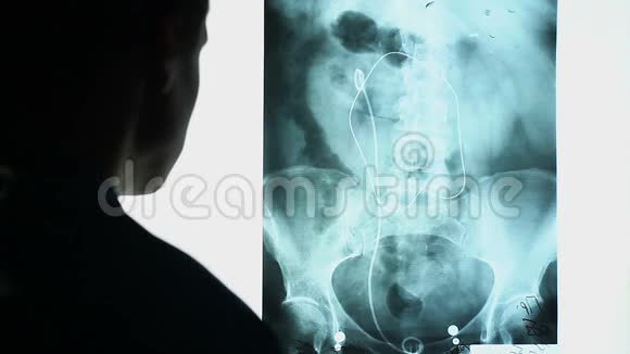 腰椎MRI扫描医生检查下半身X线图像视频的预览图