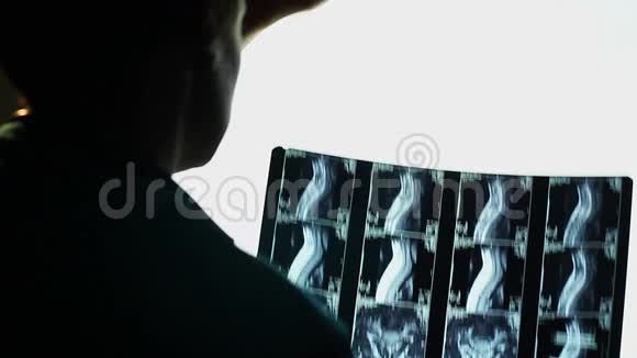 核磁共振脊柱扫描脊柱x线医生诊断视频的预览图