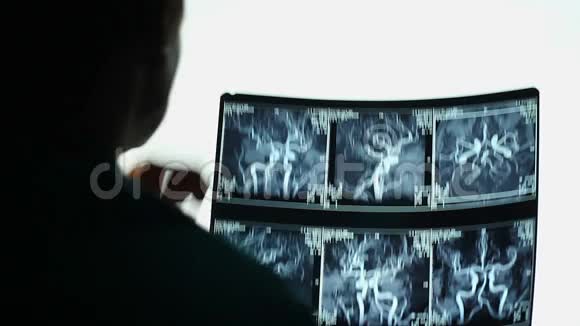 医生检查X光医学诊断MRI扫描结果视频的预览图