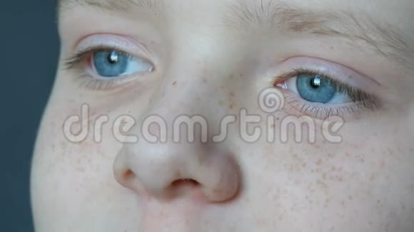 年轻的金发男孩的蓝眼睛快乐脸上长着红雀斑长着白色睫毛看着镜头视频的预览图