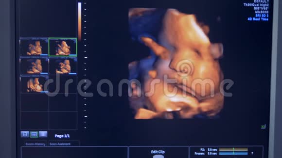 把婴儿的脸贴在超声波监视器上视频的预览图