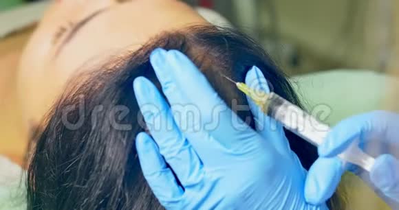 美容师在头皮上注射维生素和矿物质视频的预览图