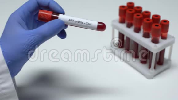 ANA档案医生在试管中显示血样实验室研究健康检查视频的预览图