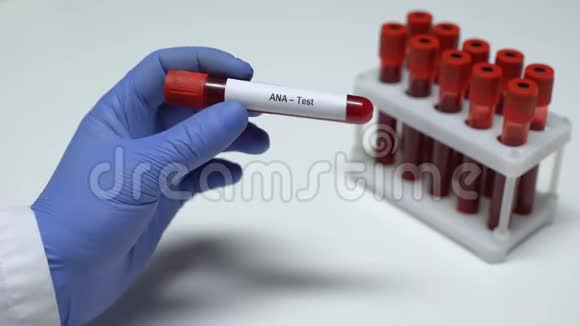 ANA测试医生在试管中显示血样实验室研究健康检查视频的预览图